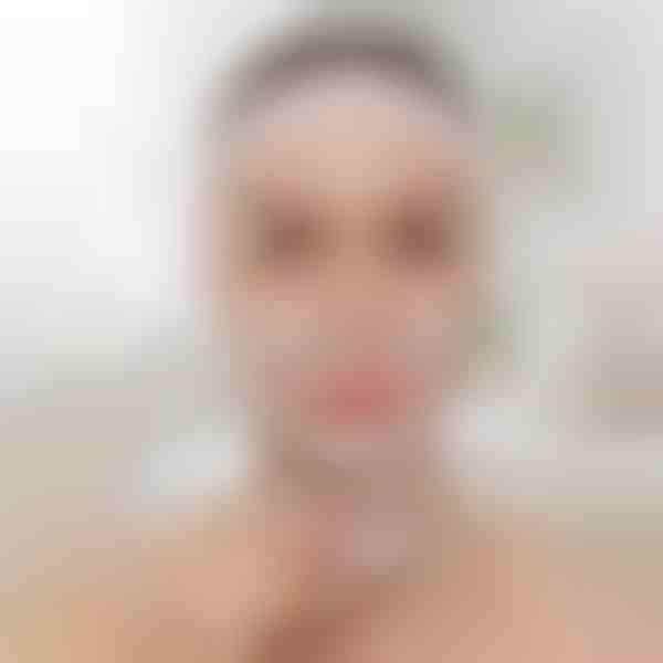 Zdvíhací pás na tvarovanie tváre | KIMLIFT